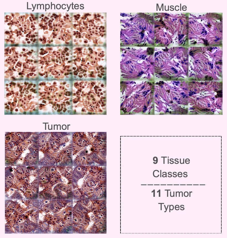 Class visualization - squares showing different tissue types like Lymphocytes, muscle an tumor